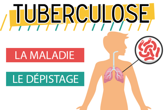 Image tuberculose 678*454