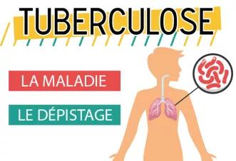 Image tuberculose 678*454