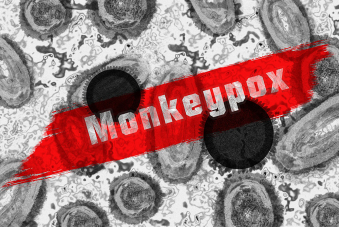 Photo monkeypox - variole du singe