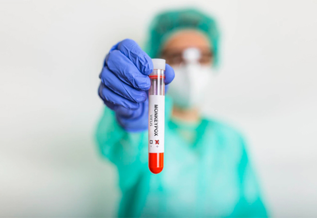 Photo virus monkeypox